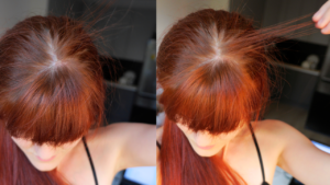 piloxidil lek na wypadanie wlosow